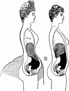 fig17-the-tilting-of-the-liver-in-certain-cases-of-tight-lacing