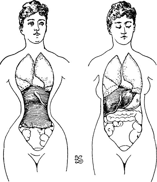 http://www.kitsch-slapped.com/wp-content/uploads/2009/11/fig6-7-squishy-guts-from-corsets.gif